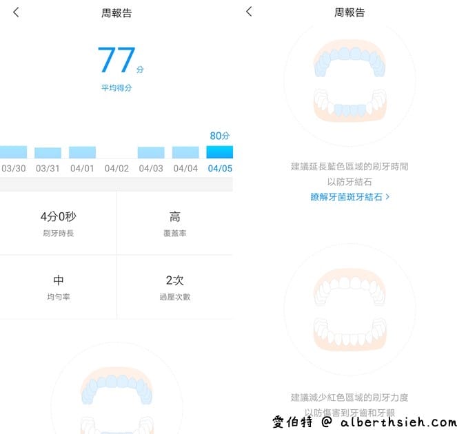 小米開箱．米家聲波電動牙刷T500（不用千元，CP值超高，18天續航）