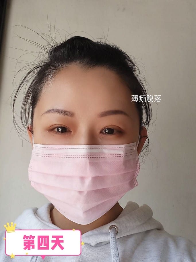 艾斯國際美學.桃園紋繡霧眉美容SPA(果然是神手級的紋繡烟霏眉,無痛感且超美) - 第37張圖 艾斯國際美學.桃園紋繡霧眉美容SPA(果然是神手級的紋繡烟霏眉,無痛感且超美)