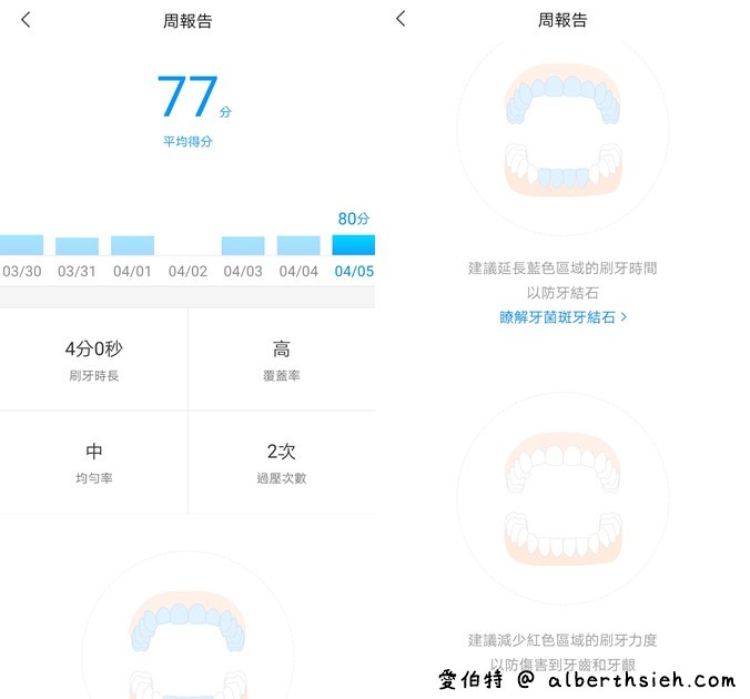 小米開箱．米家聲波電動牙刷T500（不用千元，CP值超高，18天續航） @愛伯特